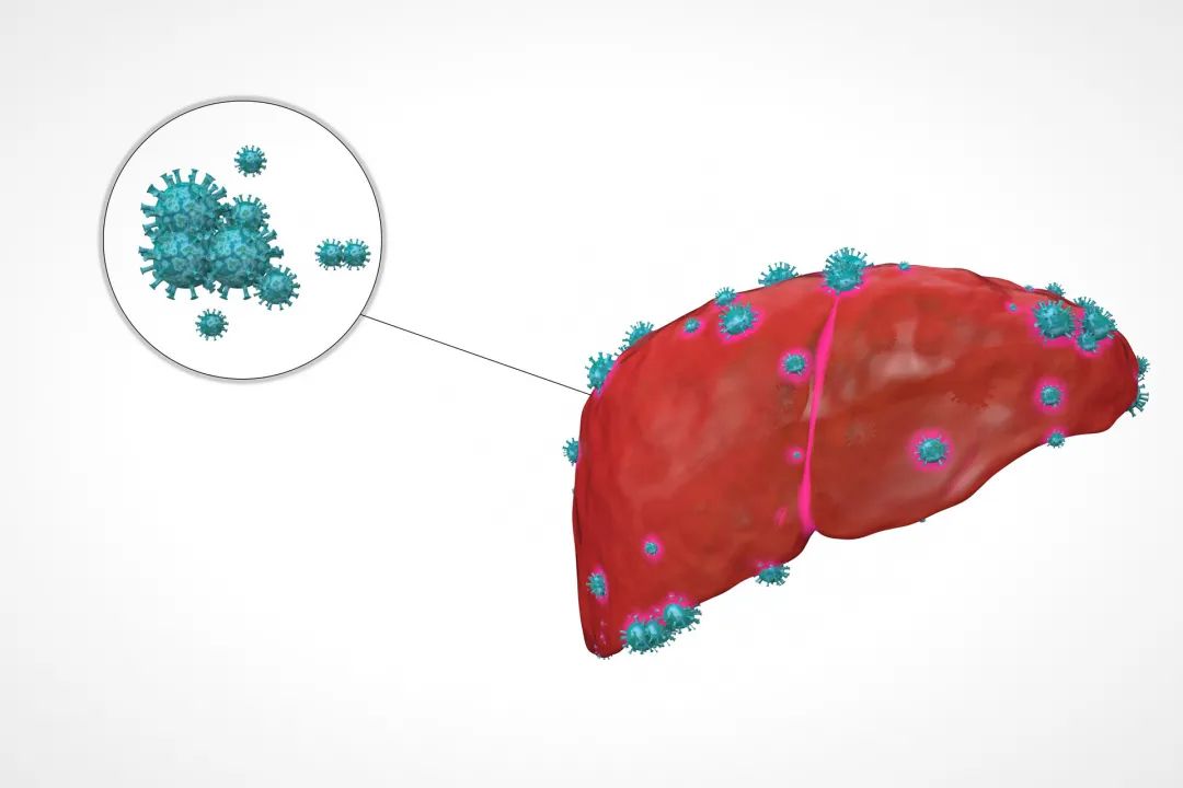 世界肝炎日 | 警惕“危险”肝炎，多项研究表明：灵芝能有效辅助防治肝炎