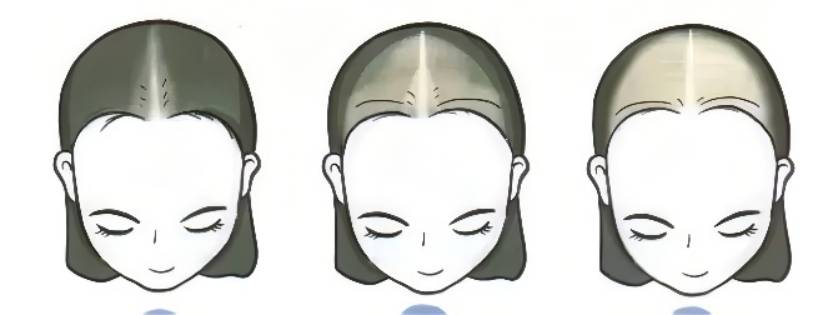 头发 头发