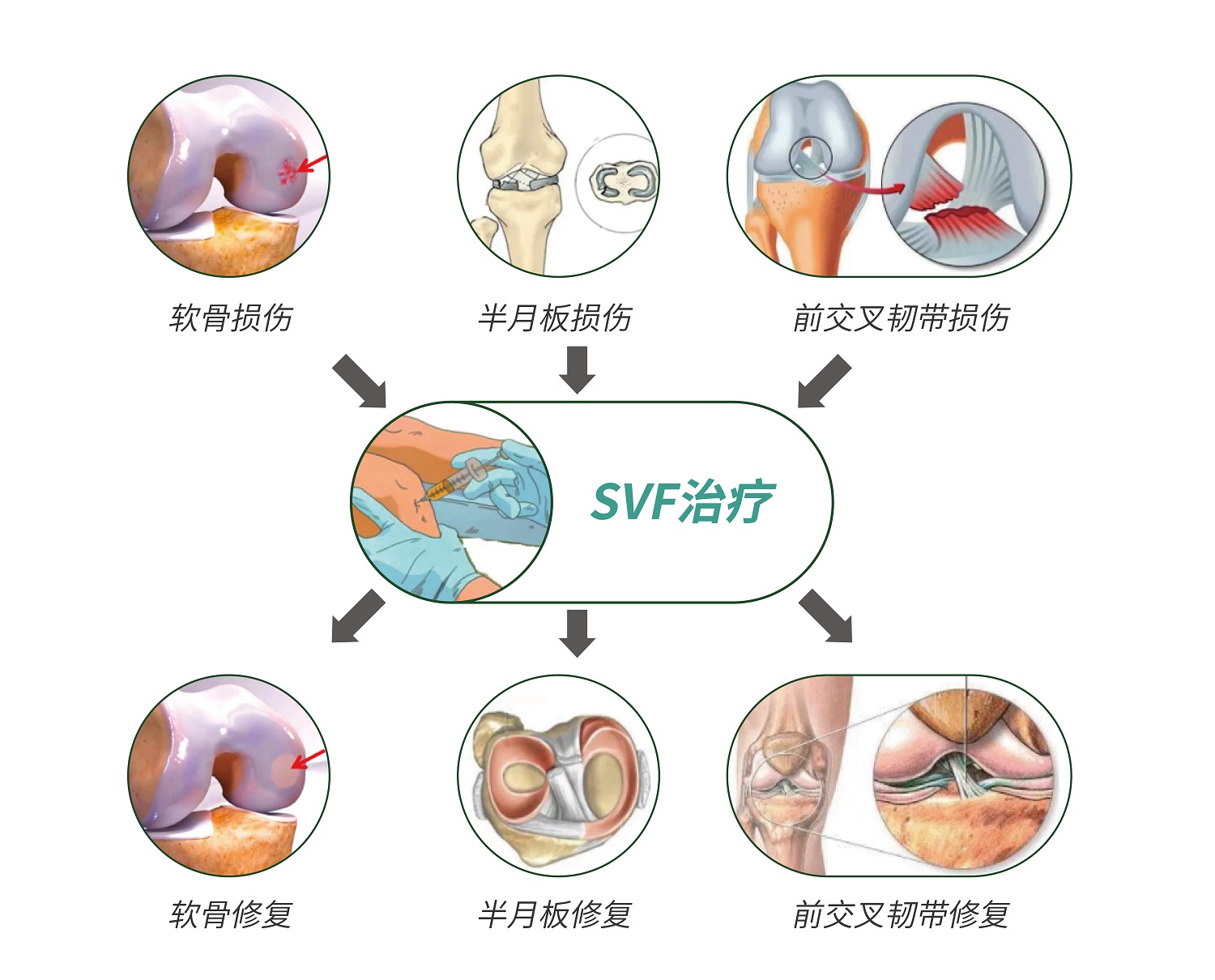 关节炎如何治疗膝盖图片