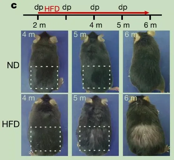 肥胖使毛囊干细胞分化成皮脂细胞，造成不可逆脱发