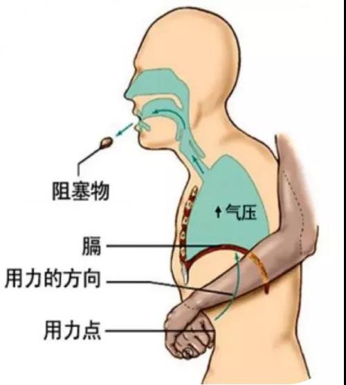 急救知识培训与演练 急救知识培训与演练