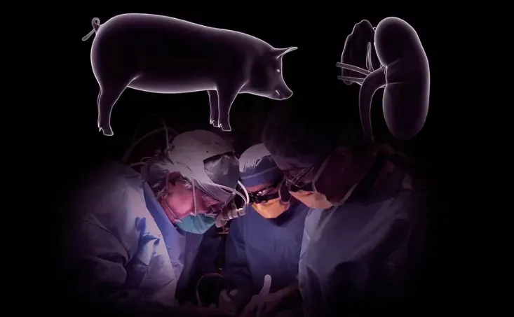 世界首例！猪肾已被移植到人体内，暂时未发生排异反应