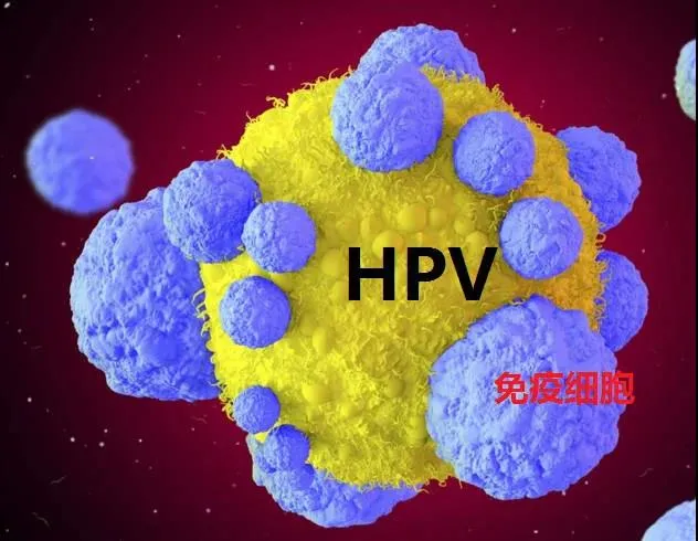 免疫细胞疗法：轻松摆脱HPV高危阳性，预防宫颈癌变风险！