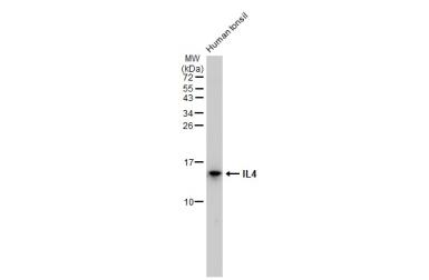 Genetex IL4抗体 [GT1225]
