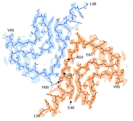 A53T α-突触核蛋白与帕金森氏症
