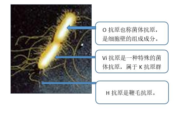 沙門氏菌檢驗(yàn)流程詳解（完結(jié)篇）