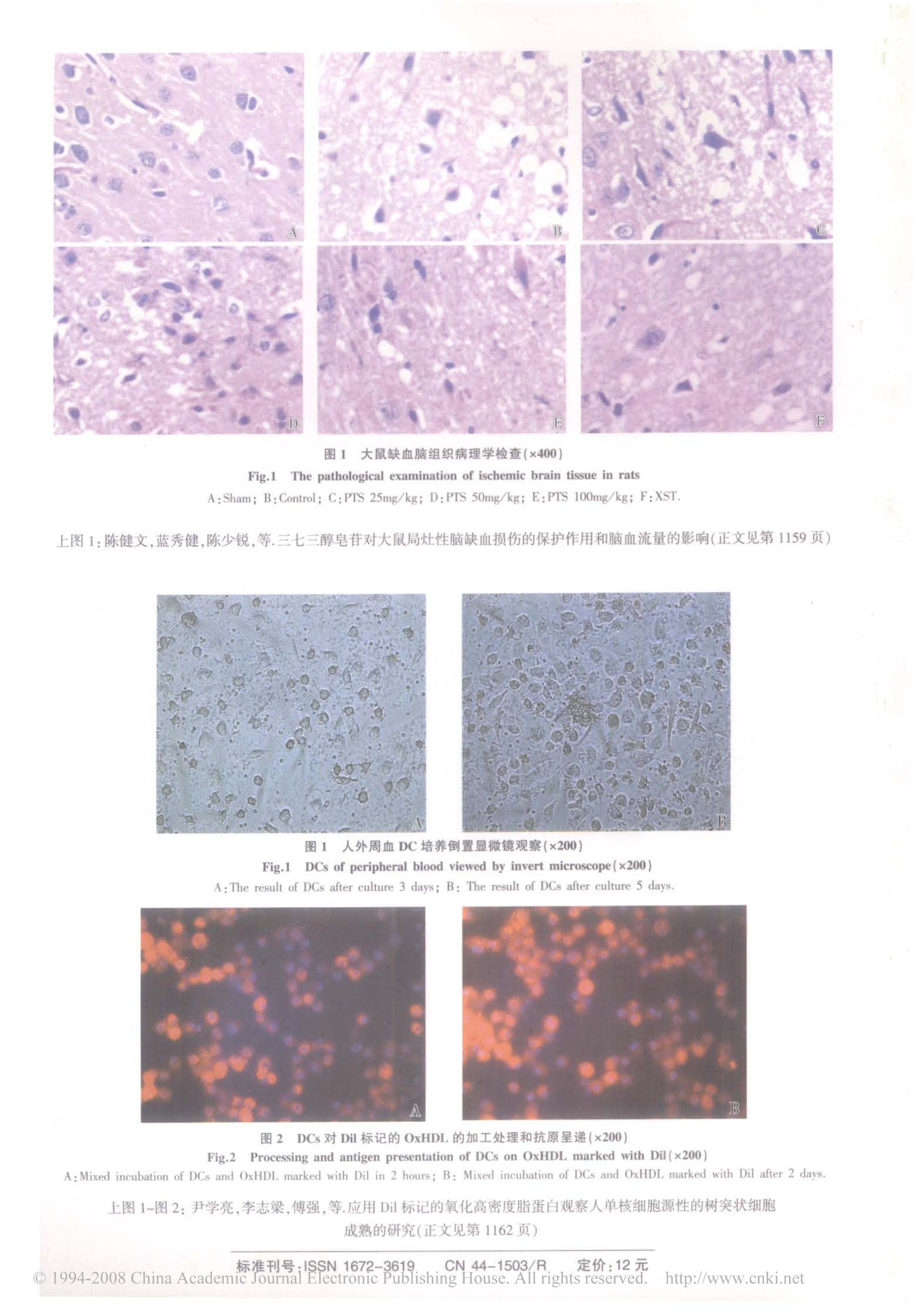 三七三醇皂苷对大鼠局灶性脑缺血损伤的保护作用和脑血流量的影响（PTS，卒中，基础研究，2007）