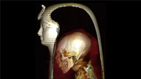 埃及科学家首次使用三维计算机断层扫描 (CT) ，解开法老阿蒙霍特普一世木乃伊的真面目