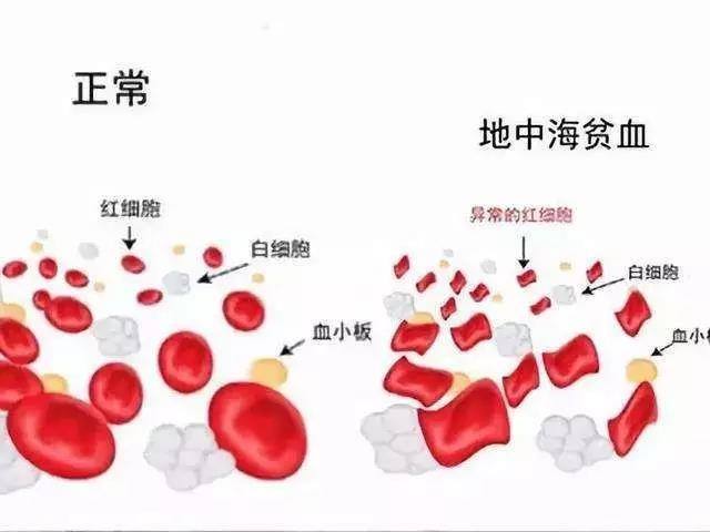 贫血初期症状轻,不用当回事?你可能低估了它… 贫血初期症状轻,不用当回事?你可能低估了它…