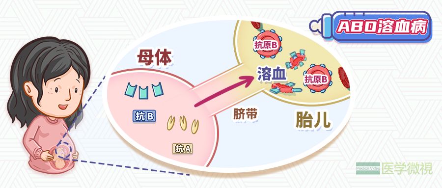 知道自己是什么型血，到底有多重要呢？