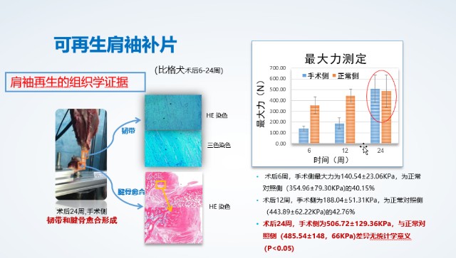 “上海制造”外科生物补片注册临床试验正式启动 “上海制造”外科生物补片注册临床试验正式启动