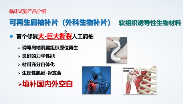“上海制造”外科生物补片注册临床试验正式启动