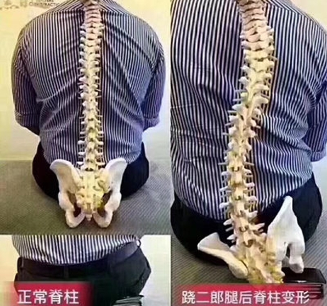 大道医:还在跷二郎腿,小心这些病症找上门 大道医:还在跷二郎腿,小心这些病症找上门