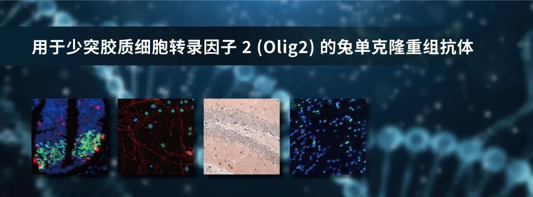 用于少突胶质细胞转录因子 2 (Olig2) 的兔单克隆重组抗体