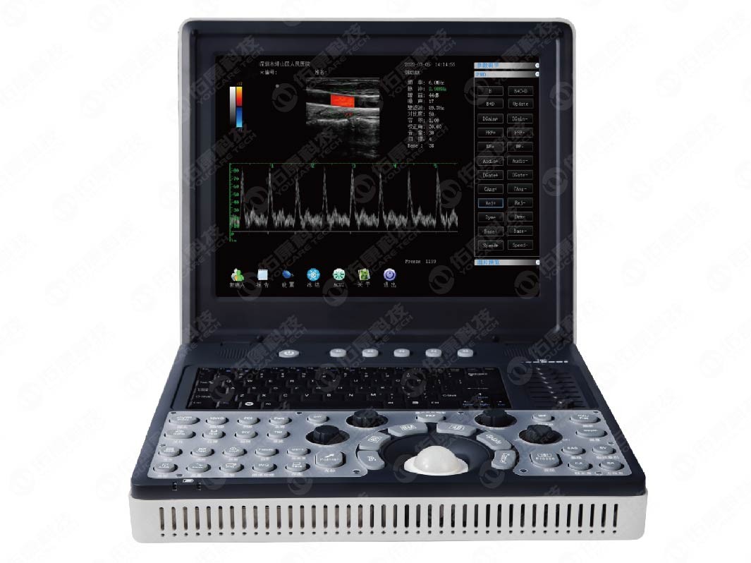 Medical Ultrasound Instruments Portable Color Doppler Digital Ultrasound Machine YC-DUD-A