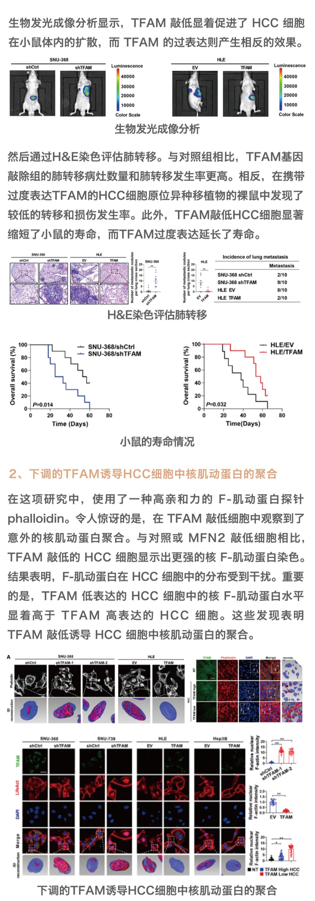 客户致谢文章｜IF=11.598 邢金良、黄启超团队揭示线粒体代谢障碍通过诱导细胞核actin多聚化促进肝癌转移新机制