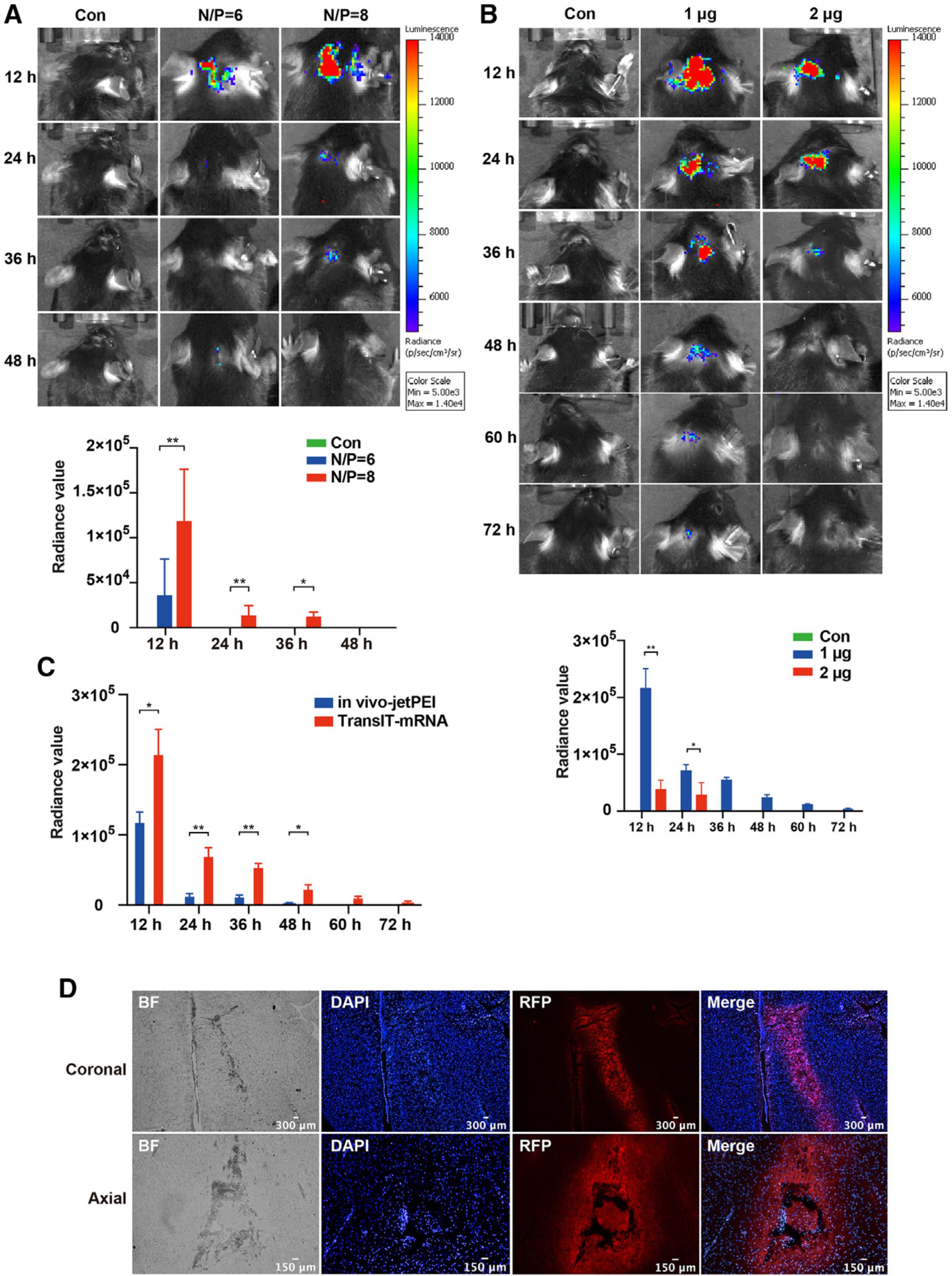 TransIT-mRNA转染试剂协助活体颅内递送mRNA药物抑制胶质母细胞瘤