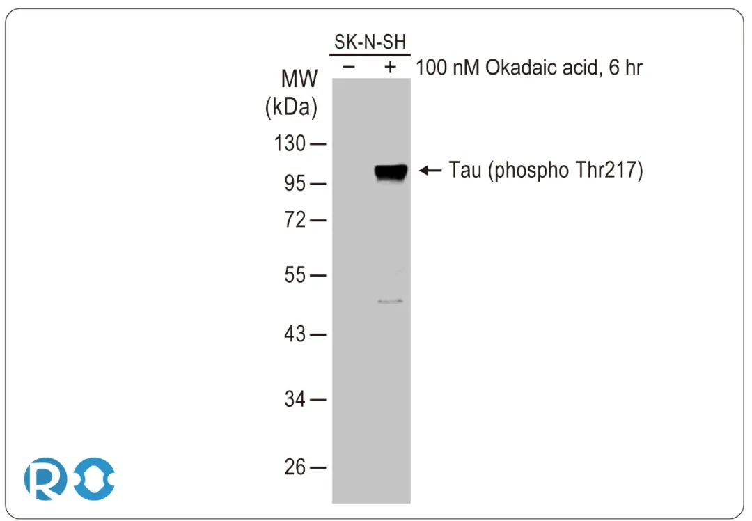 Tau phospho-Thr217：早期阿尔茨海默氏病生物标志物