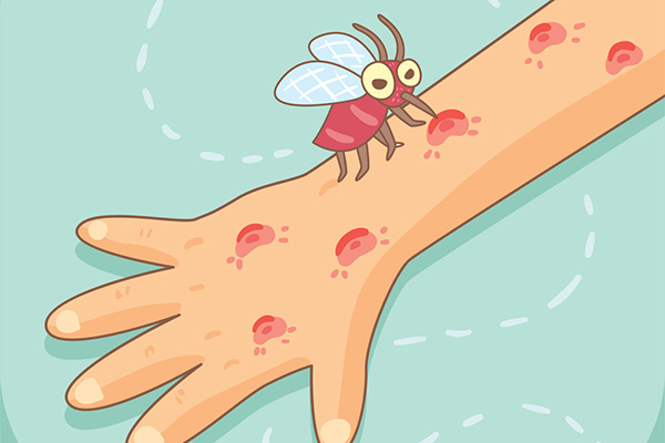 小孩老是被蚊子咬，怎样才能进行防范？