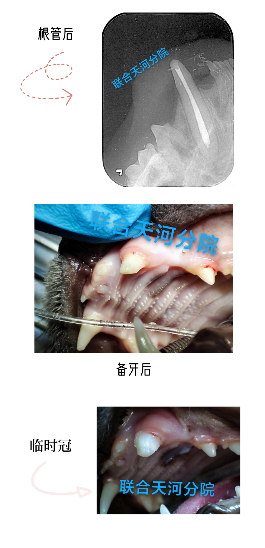 拥有定制牙冠后，我步入了上流社会……