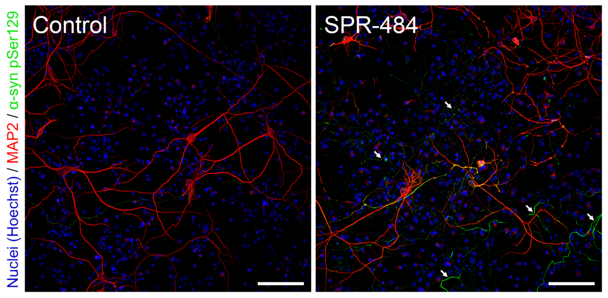 神经衰退疾病研究新工具---α-突触核蛋白寡聚体(SPR-484)