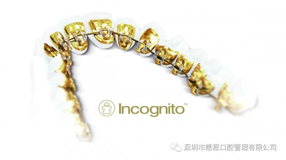 打造高品质正畸服务，Incognito黄金舌侧矫正中心正式成立