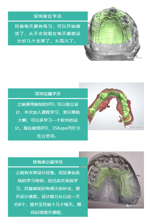 澳门人威尼斯4399DPR支架设计培训课程回顾及效果跟进