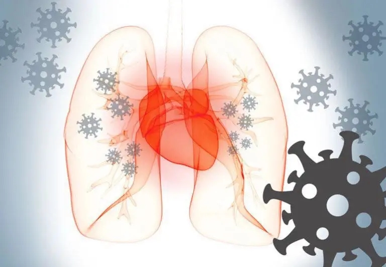 肺癌化疗不良反应处理方法（二）