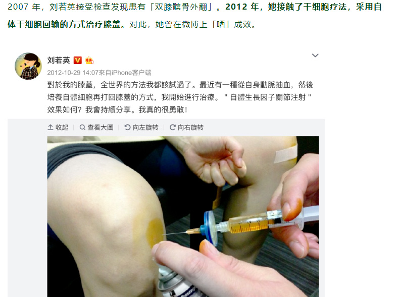 当你还在质疑时，这些名人明星早已用上干细胞了