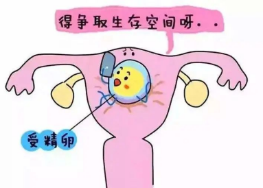 反复的宫腔粘连该如何治疗,才能“一治永逸”? 反复的宫腔粘连该如何治疗,才能“一治永逸”?