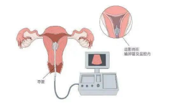 六个影响我试管进程的绊脚石需要等多久? 六个影响我试管进程的绊脚石需要等多久?