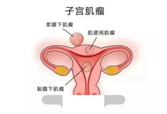 六个影响我试管进程的绊脚石需要等多久? 六个影响我试管进程的绊脚石需要等多久?