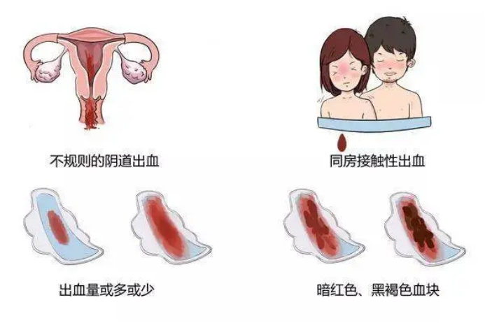 如何简单计算预产期? 如何简单计算预产期?