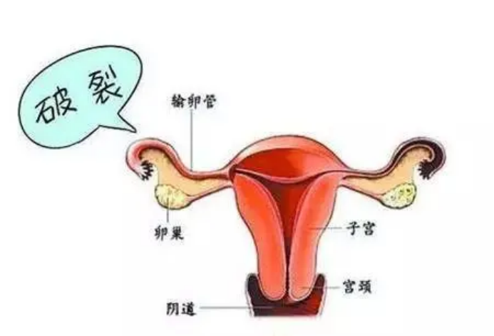 如何简单计算预产期？