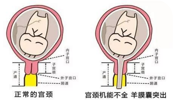 宫颈会有的那些事！