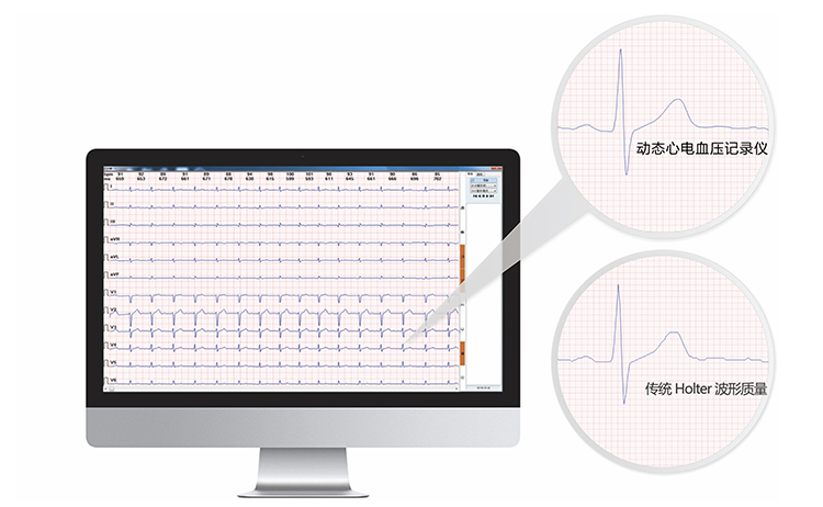 动态心电血压记录仪