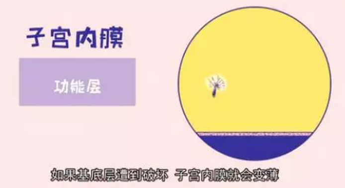 为什么医生要我做宫腔镜? 为什么医生要我做宫腔镜?