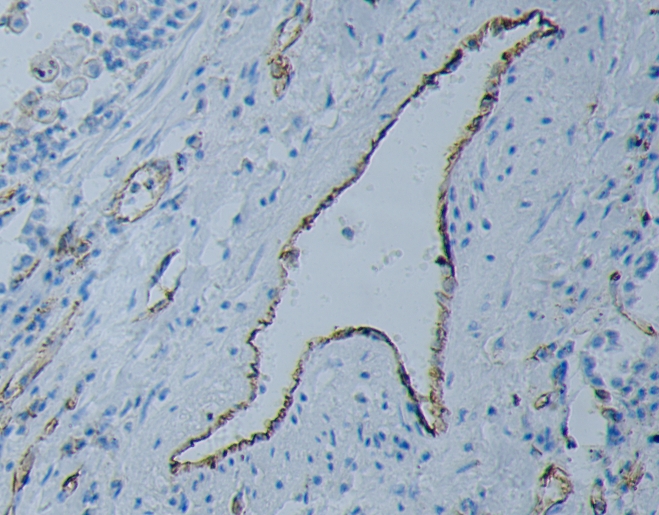 GZ112   CD31 抗体试剂(免疫组织化学)