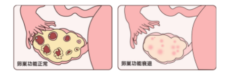 试管失败，两回胎停，三次手术！四年未孕又查出甲状腺癌的她竟然怀孕了！