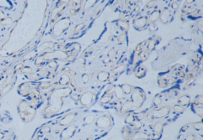 GZ113   CD34抗体试剂(免疫组织化学)