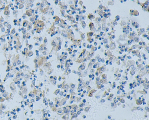 GZ137   E-Cadherin 抗体试剂(免疫组织化学)