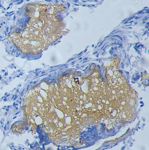 GZ061  胶质纤维酸性蛋白（Glial Fibrillary Acidic Protein，GFAP） 抗体试剂(免疫组织化学)