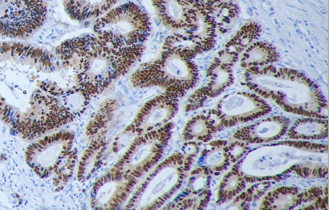 GZ151  CDX-2 抗体试剂(免疫组织化学)