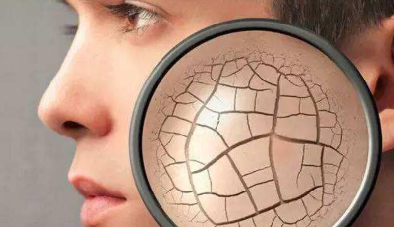 如何挑选适合自己肤质的化妆品？