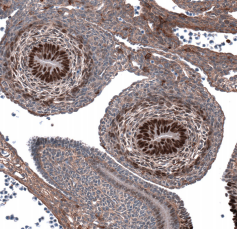 Atlas Antibodies热销Top10癌症标志物PrecisATM单克隆抗体