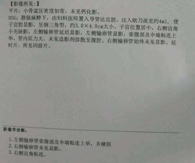 成功案例:泰国三代试管归来,终于有了自己的儿子 成功案例:泰国三代试管归来,终于有了自己的儿子