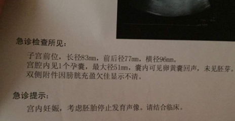 丈夫染色体平衡位,2次胎停,赴泰国试管一次好孕 丈夫染色体平衡位,2次胎停,赴泰国试管一次好孕