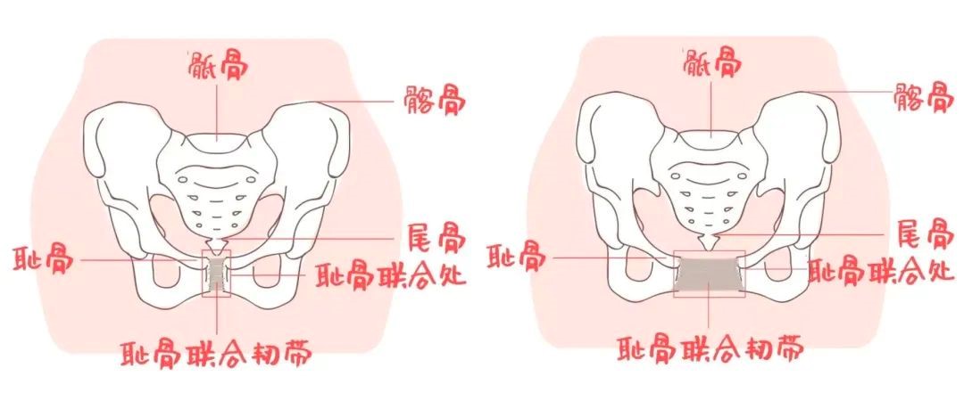 产后骨盆修复,是如何一步步掏空你的钱包 产后骨盆修复,是如何一步步掏空你的钱包