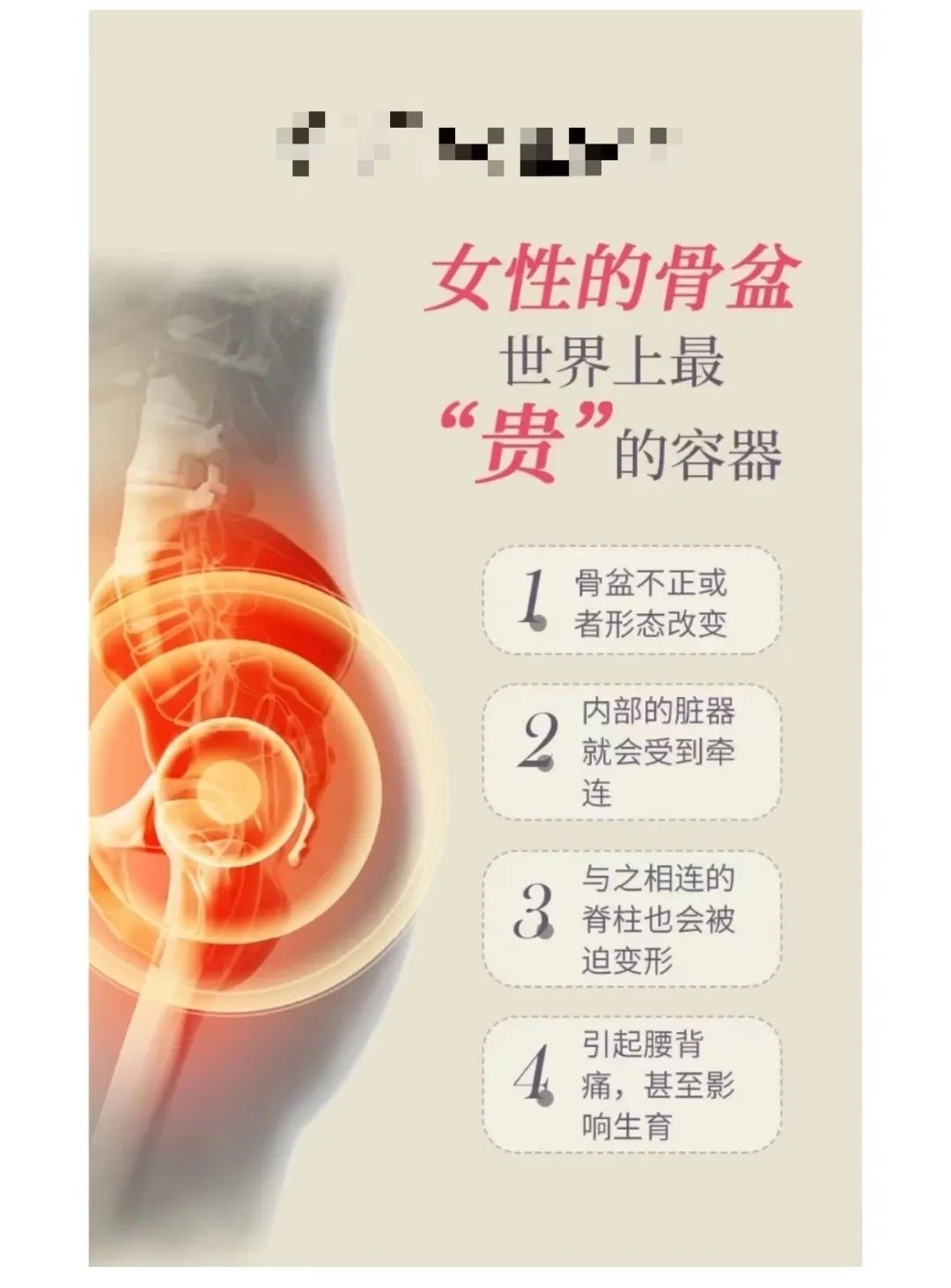 产后骨盆修复,是如何一步步掏空你的钱包 产后骨盆修复,是如何一步步掏空你的钱包