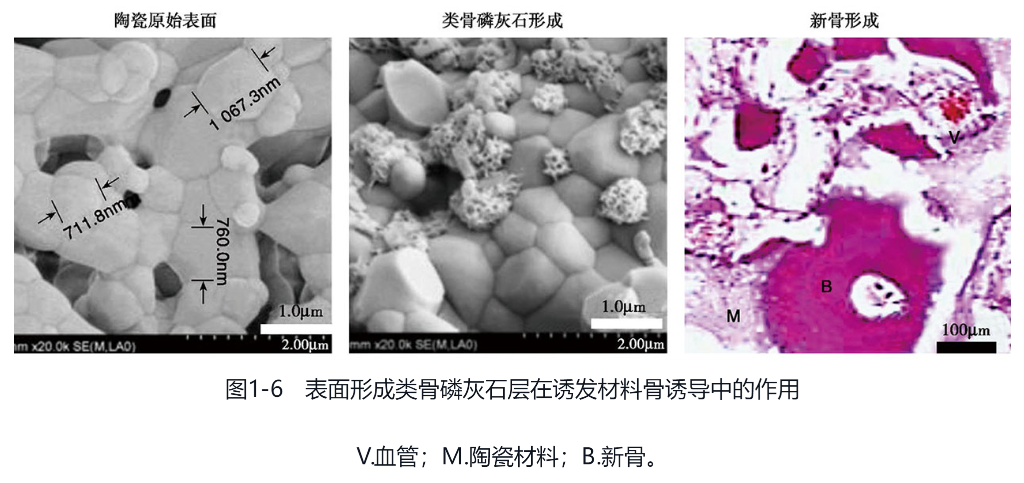 Q1-1骨诱导再生的生物材料